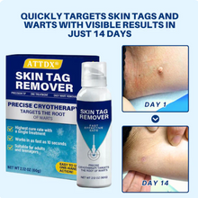 Load image into Gallery viewer, ATTDX® TagRecede Cryo Treatment Spray