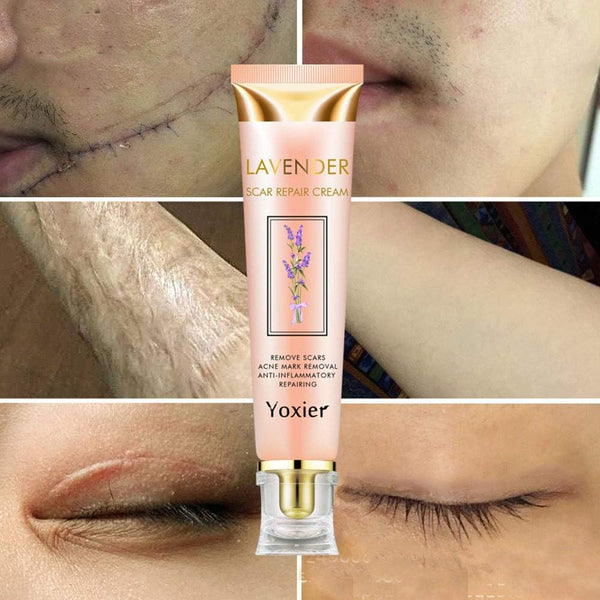 ScarErase Deep Repair Face Cream