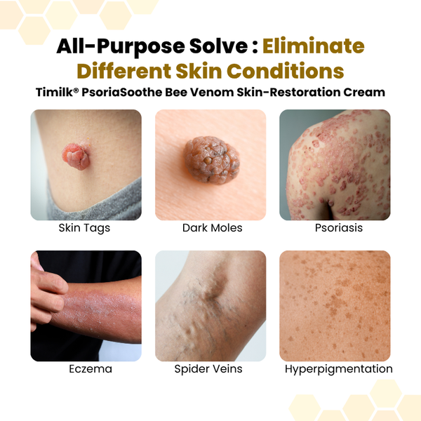 PsoriaSoothe Relief Cream